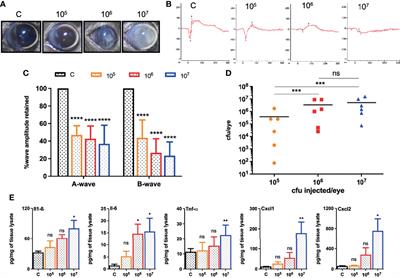 Bacterial Burden Declines But Neutrophil Infiltration and Ocular Tissue Damage Persist in Experimental Staphylococcus epidermidis Endophthalmitis